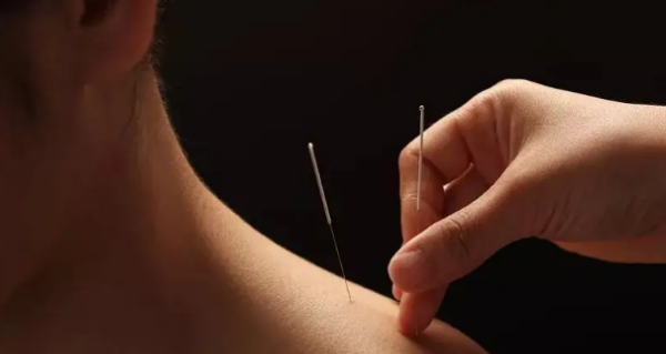 针灸所用的九针是谁发明的,针灸所用九针是哪位神话人物发明的图2