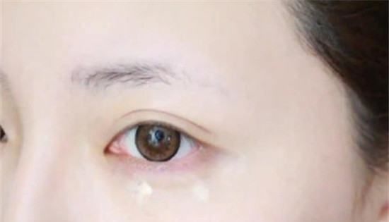 眼霜的使用方法,眼霜的正确使用方法图11