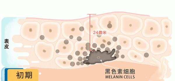 咸鸭蛋壳内壁有黑点能吃,干腌咸鸭蛋外壳出现黑点能吃了吗图2