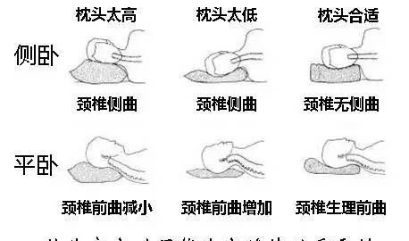 人睡觉枕头的枕后最佳高度是多少
