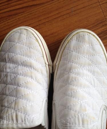 为什么白鞋子洗后泛黄斑