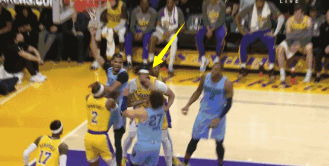 浓眉被打出血(究竟是打球还是打人)