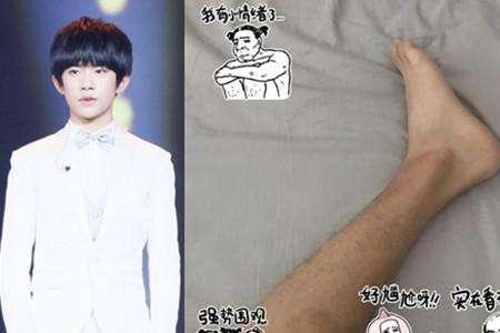 娱乐圈有腿毛的明星，胡歌的最长，最后一位说自己的是有机毛裤