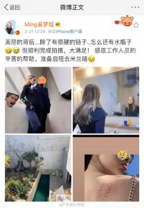 ​奚梦瑶分享后背伤痕照，照片中她正在进行广告拍摄