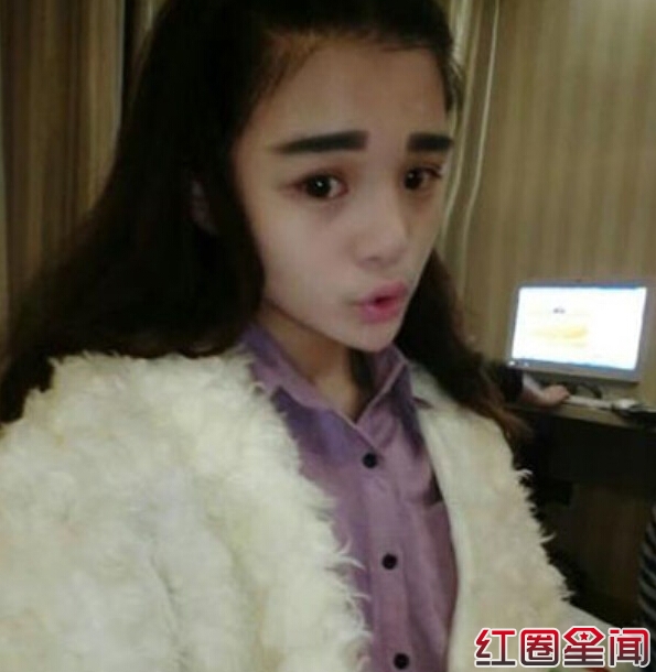 变形计李耐阅整容 自残原因曝光