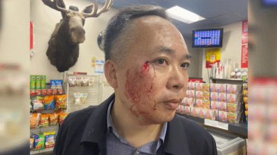 ​中国教授在美国街头用功夫击退持枪劫匪：回想起来有点后怕，不建议大家这样做