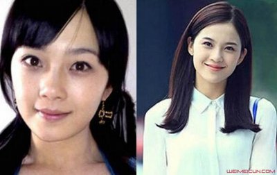 ​赵韩樱子怎么变样了 赵韩樱子整容前后对比
