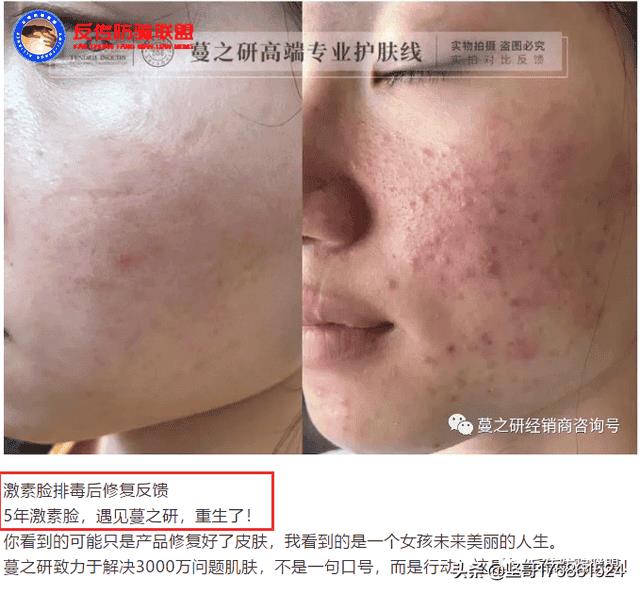 蔓之研代理真的这么好吗(蔓之研护肤品怎么样)