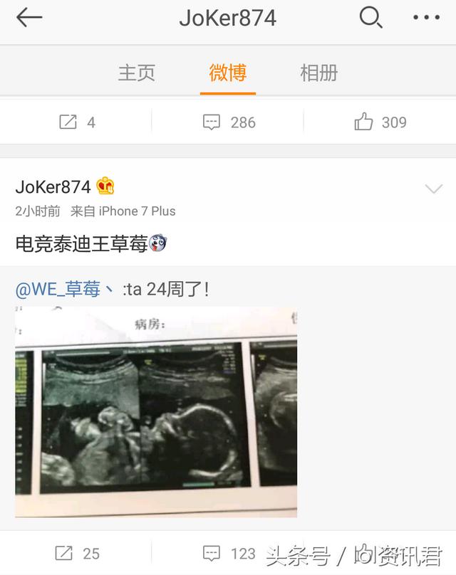 lol路人王草莓（草莓喜得二胎Joker电竞泰迪王草莓）(1)