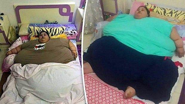 全球最胖的女人，体重1000斤，在床上整整躺了25年之久