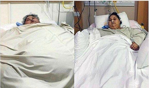 全球最胖的女人，体重1000斤，在床上整整躺了25年之久