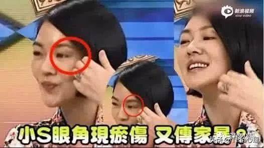 小s到底怎么了(我为什么心疼小S)(15)
